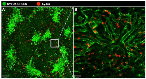Differential Location and Distribution of Hepatic Immune Cells