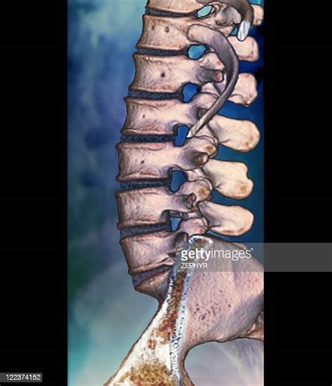 Image result for Normal Profile CT