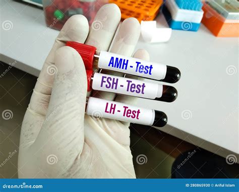 Blood Samples Tube with Sample for AMH, FSH and LH Test. Stock Photo ...