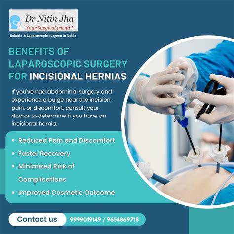 Laparoscopic surgery for incisional hernias | Robotic and Laparoscopic hernia and gallstone ...