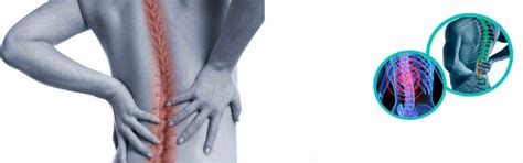 Spinal Surgery Or Spine Surgery In Hawaii, Spinal Surgery Or Spine ...