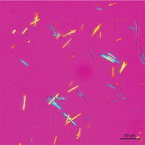 Monosodium Urate