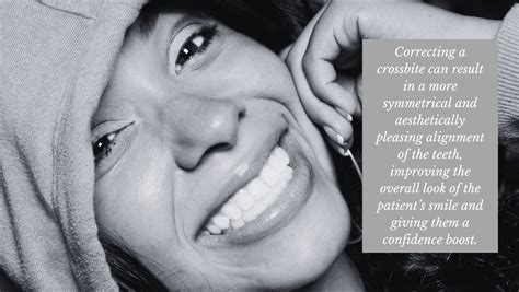 Image result for Crossbite Treatment Options