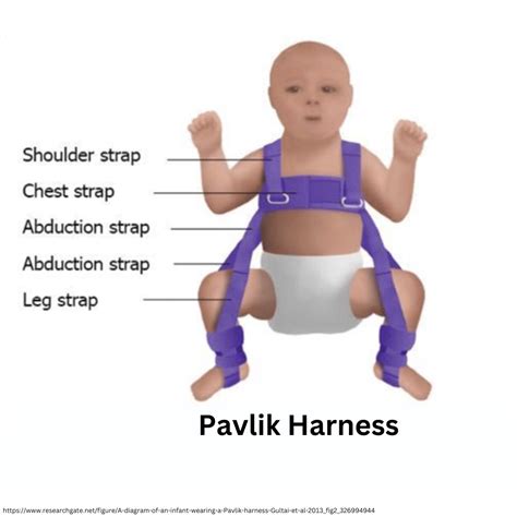 Baby Harness Hip Dysplasia at Carol Walsh blog