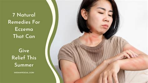 7 Natural Remedies For Eczema That Can Give Relief This Summer ...