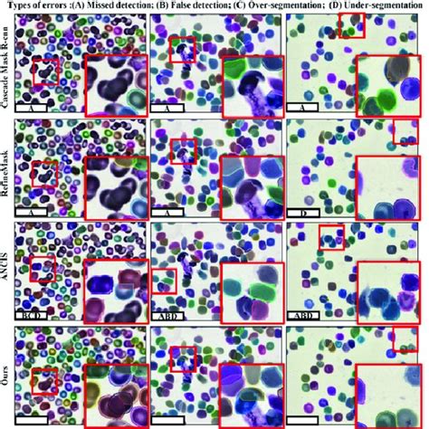Image result for Cell Segmentation Methods