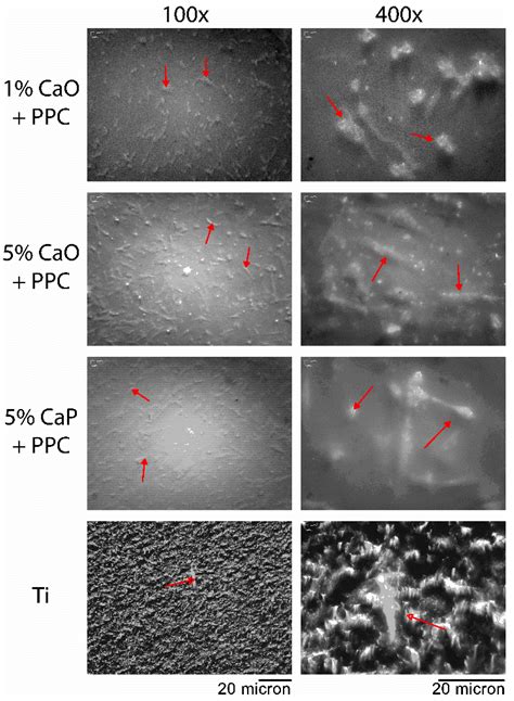 Novel Development of Biocompatible Coatings for Bone Implants