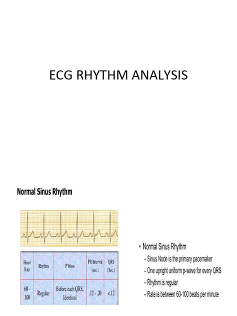 Image result for R-R Interval Calculation for ECG Code in Python