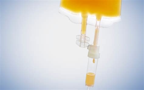 Vitamin D Infusion Hamburg at Timothy Dematteo blog