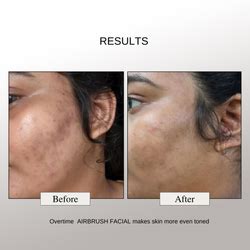 Barrier Relief Lightweight Ceramide Moisturizer - For Oily, Combination ...