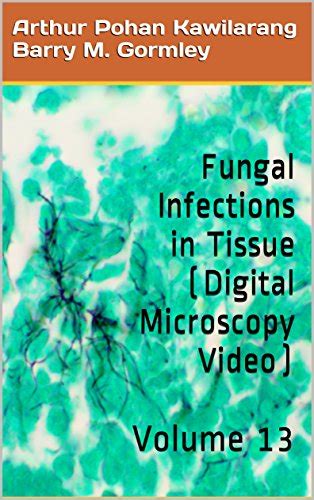 Fungal Infections in Tissue (Digital Microscopy Video): Volume 13 eBook ...