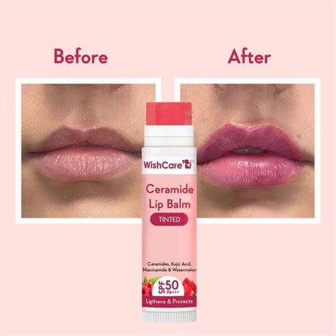 WishCare Tinted Ceramide Lip Balm with SPF50 PA+++ - Kojic Acid ...