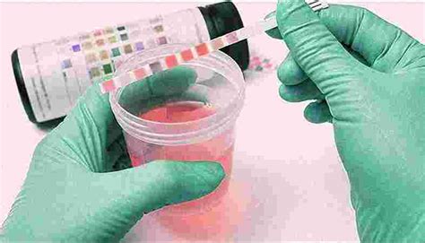 Florance Labs - Top Blood Test & Path Labs in Banamalipur Agartala