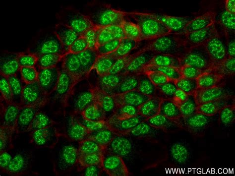 IMUP antibody (84148-6-RR) | Proteintech