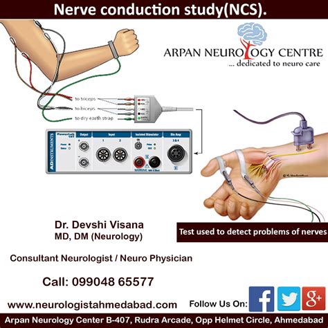 NCS is a test to detect disorder of nerves. This test is indicated if patient has following ...