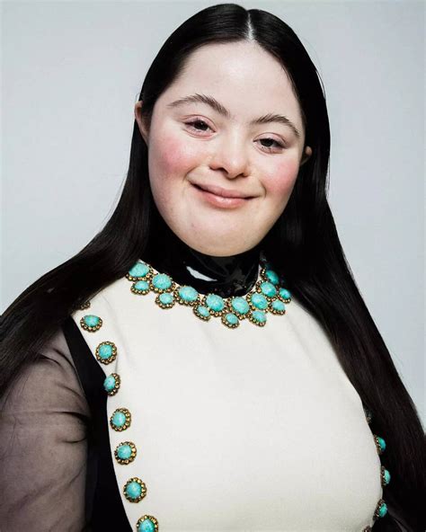 First Down’s syndrome model Ellie Goldstein who campaigned for Gucci ...