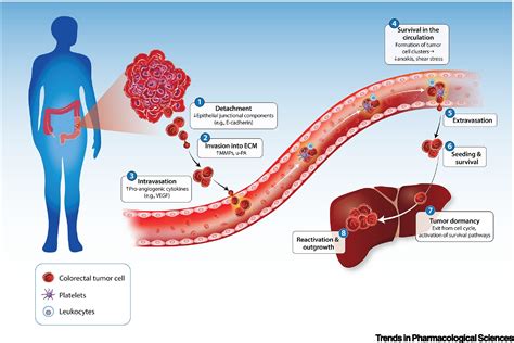 Metastatic Colorectal Cancer Prescription
