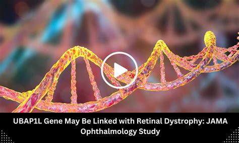 UBAP1L Gene May Be Linked with Retinal Dystrophy: JAMA Ophthalmology