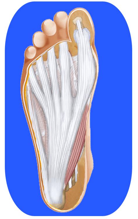 Plantar Fasciitis Pain Treatment NYC / Foot and Ankle Clinic