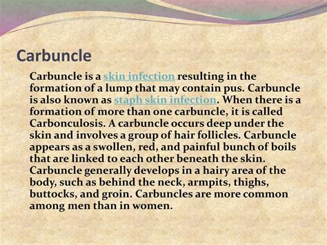 Carbuncle Core 的图像结果