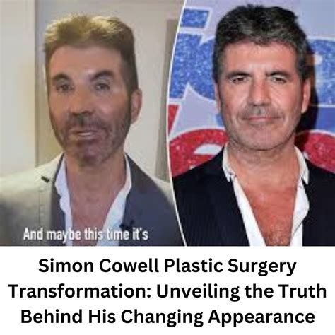 Simon Cowell Plastic Surgery Transformation: Unveiling the Truth Behind ...