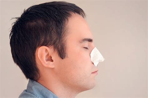 Do Pimple Patches Actually Work? – mars by GHC