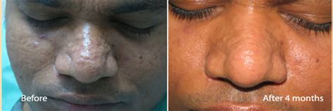 Derma Vision - Centre for Skin, Hair, Nail & Cosmetic Care