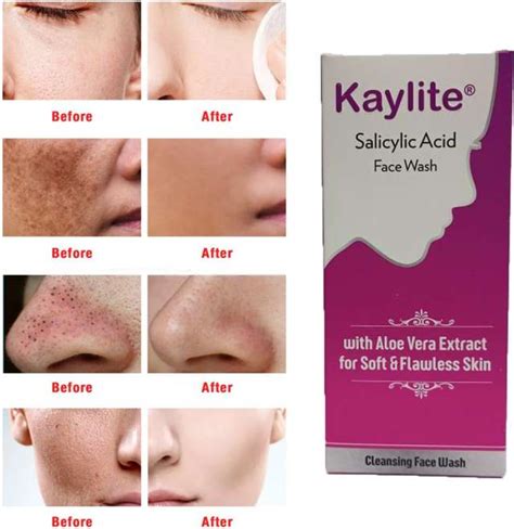 Face Wash - Buy Best Face Wash For Men & Women Online | Shopsy