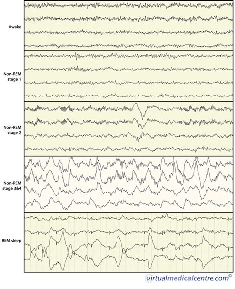 Sleep 的图像结果