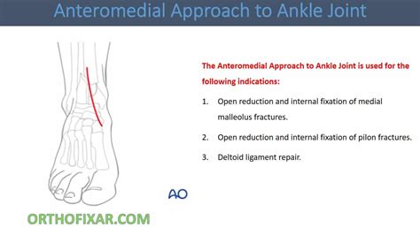 Image result for Ankle Injection Lateral Approach