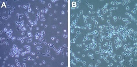 YUMM1.7D5 Mouse Melanoma Cell Line | SCC228