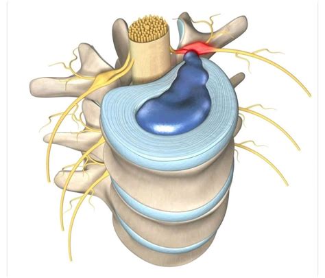 Disk Problem 的图像结果