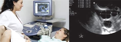 Follicular Monitoring in Juhu | Dr. Nikita Lad Patel