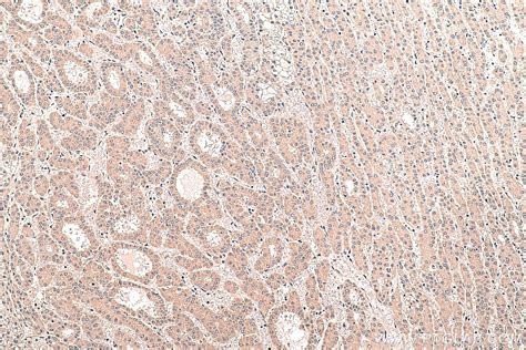 IHCeasy SMAD1 Ready-To-Use IHC Kit KHC0389 | Proteintech