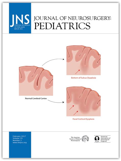 Trends in surgical treatment of Chiari malformation Type I in the ...