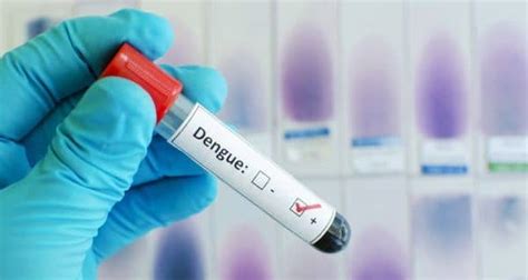 High haemoglobin levels in dengue patients indicate medical emergency ...