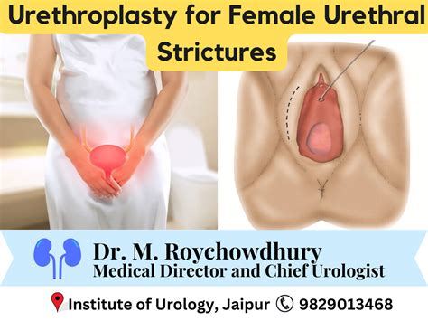 Healthy Female Urethra