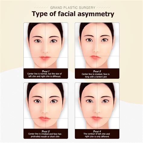Asymmetrical Face Causes