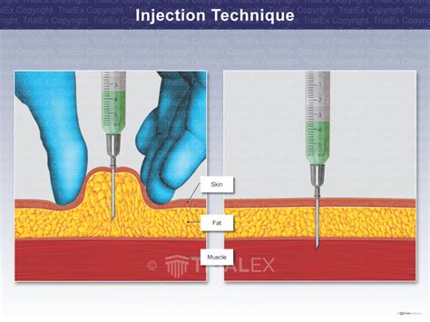 Injection Method Tutorial 的图像结果