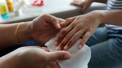 How Scabs Form and Why They Itch | Britannica