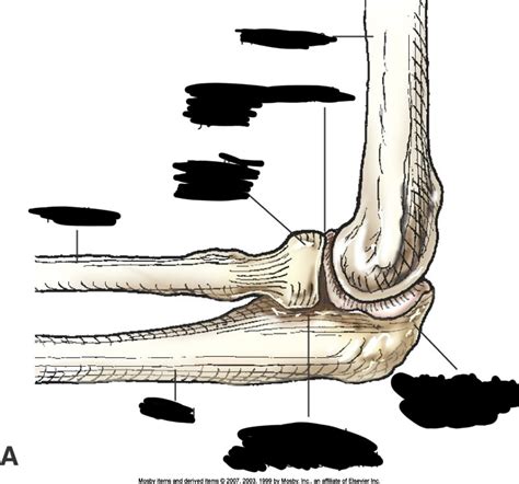Image result for Elbow Contralateral