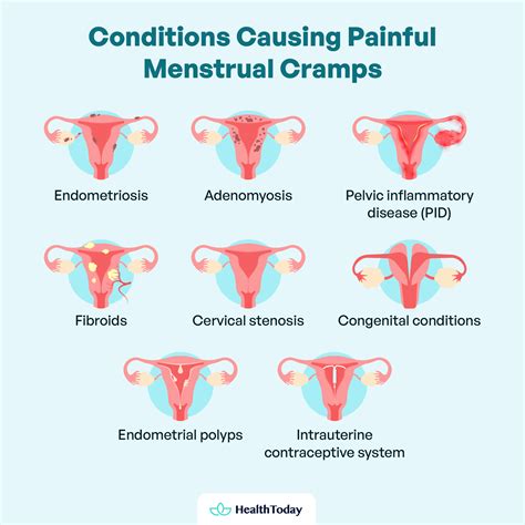 Menstrual Cramps No Period