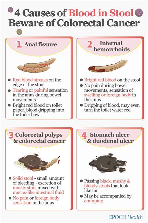 Blood In Poo Pictures