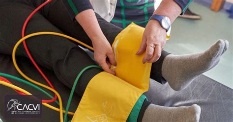 Image result for Leg Circulation Problems Symptoms