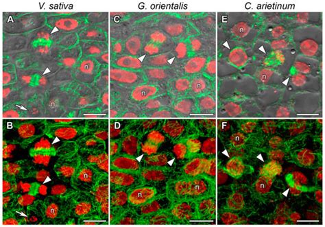 Cells | Special Issue : The Role of the Plant Cytoskeleton in Signal ...