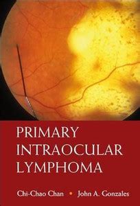 Primary Intraocular Lymphoma: Buy Primary Intraocular Lymphoma by Chan ...