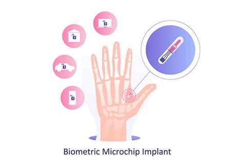 RFID-Chips in der Hand - sieht so die Zukunft aus? - RFID | Allgemeine ...