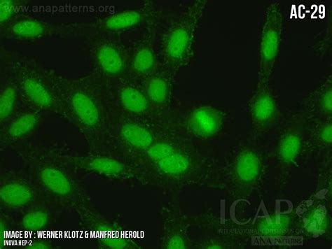 Image result for Ana Pattern Screen