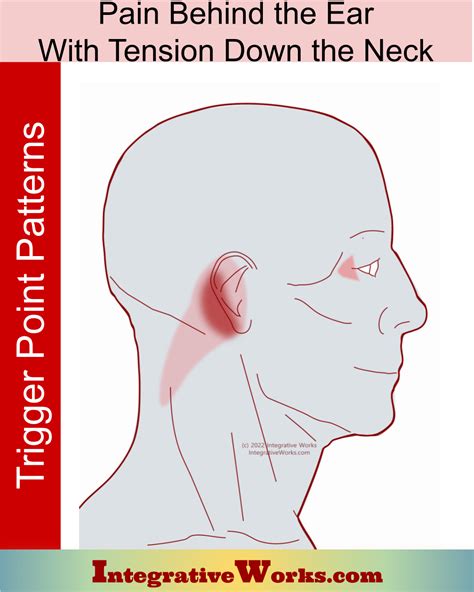neck Archives - Integrative Works