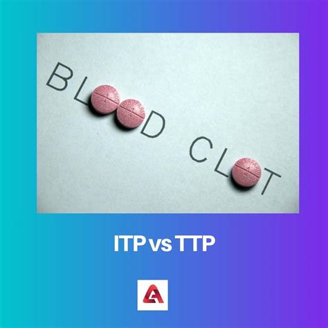 ITP vs TTP: Difference and Comparison